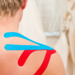 Medical taping bij Fysiotherapie van Benten in Kralingen